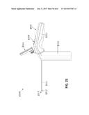 TISSUE VISUALIZATION AND MODIFICATION DEVICES AND METHODS diagram and image