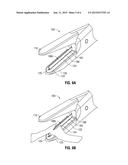 SURGICAL FORCEPS diagram and image