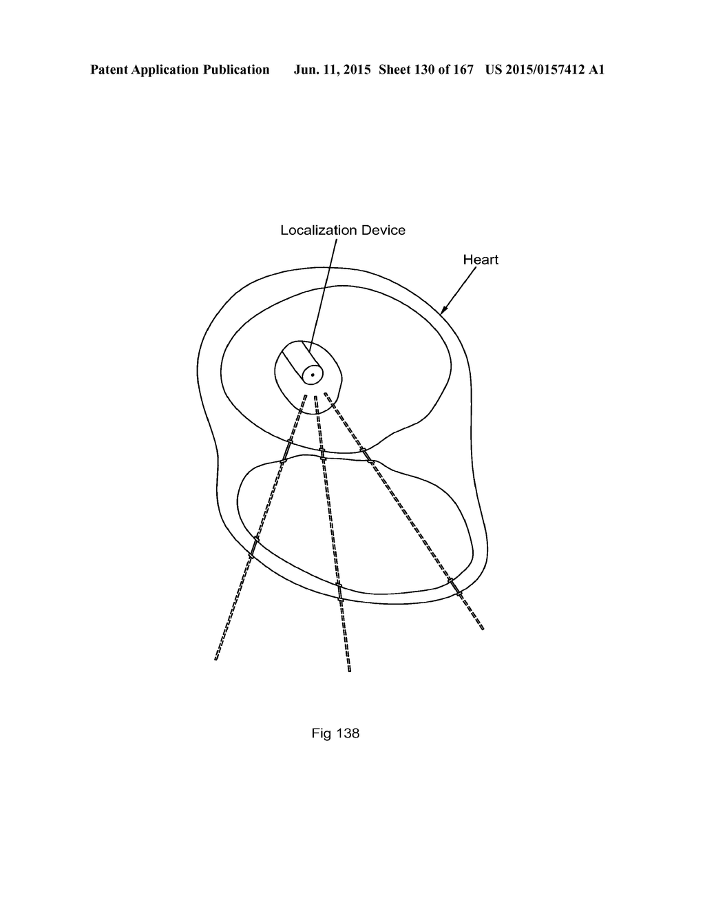 ROBOTIC CATHETER SYSTEM - diagram, schematic, and image 131