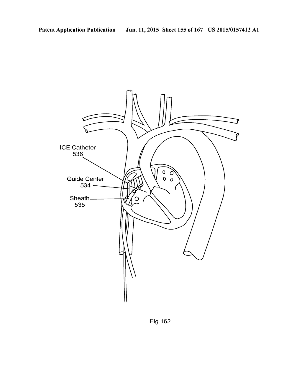 ROBOTIC CATHETER SYSTEM - diagram, schematic, and image 156