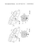 DENTAL BRIDGE ATTACHMENT SYSTEM AND METHOD diagram and image