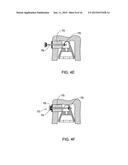 DENTAL BRIDGE ATTACHMENT SYSTEM AND METHOD diagram and image