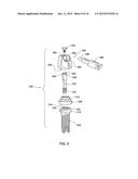 DENTAL BRIDGE ATTACHMENT SYSTEM AND METHOD diagram and image