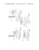 DENTAL BRIDGE ATTACHMENT SYSTEM AND METHOD diagram and image