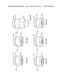 DENTAL BRIDGE ATTACHMENT SYSTEM AND METHOD diagram and image