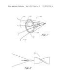 Method of Treating Occlusion in a Blood Vessel diagram and image