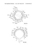 BRACE HAVING AN INFLATION CONTROL diagram and image