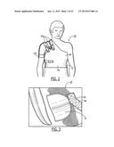 SEMI-RIGID SHOULDER BRACES AND RELATED METHODS diagram and image