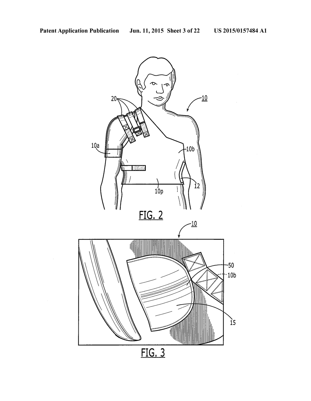 SEMI-RIGID SHOULDER BRACES AND RELATED METHODS - diagram, schematic, and image 04