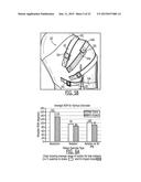 SEMI-RIGID SHOULDER BRACES AND RELATED METHODS diagram and image