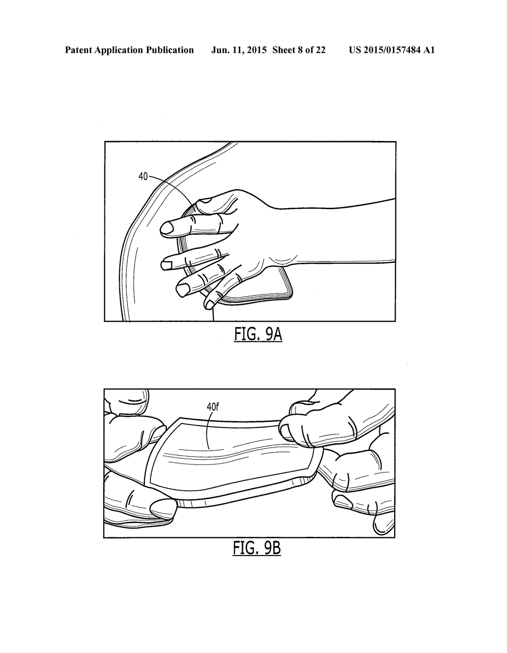 SEMI-RIGID SHOULDER BRACES AND RELATED METHODS - diagram, schematic, and image 09