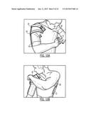 SEMI-RIGID SHOULDER BRACES AND RELATED METHODS diagram and image