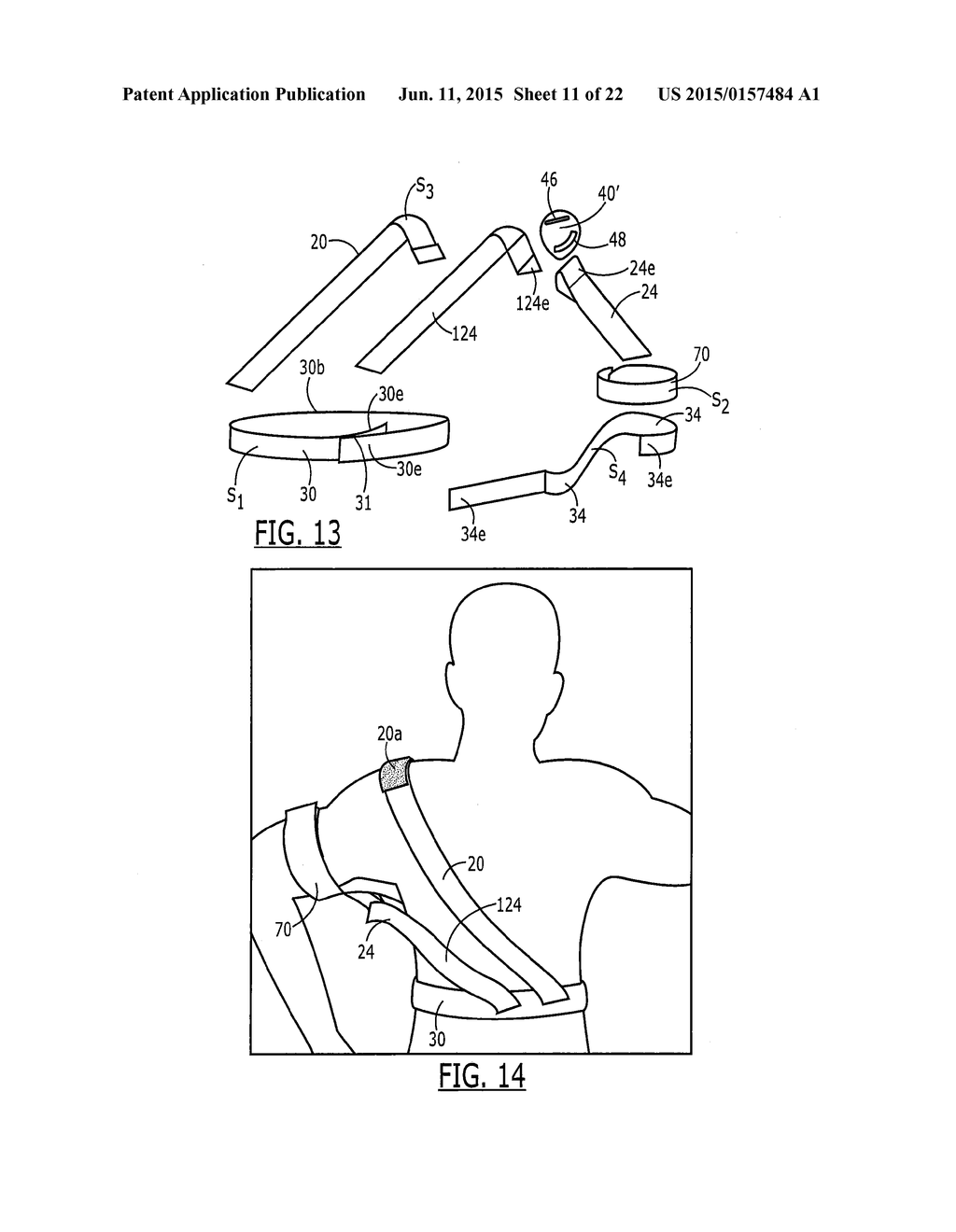 SEMI-RIGID SHOULDER BRACES AND RELATED METHODS - diagram, schematic, and image 12