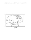 SEMI-RIGID SHOULDER BRACES AND RELATED METHODS diagram and image