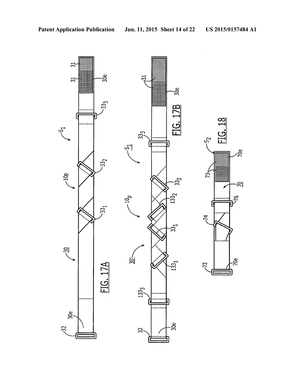 SEMI-RIGID SHOULDER BRACES AND RELATED METHODS - diagram, schematic, and image 15