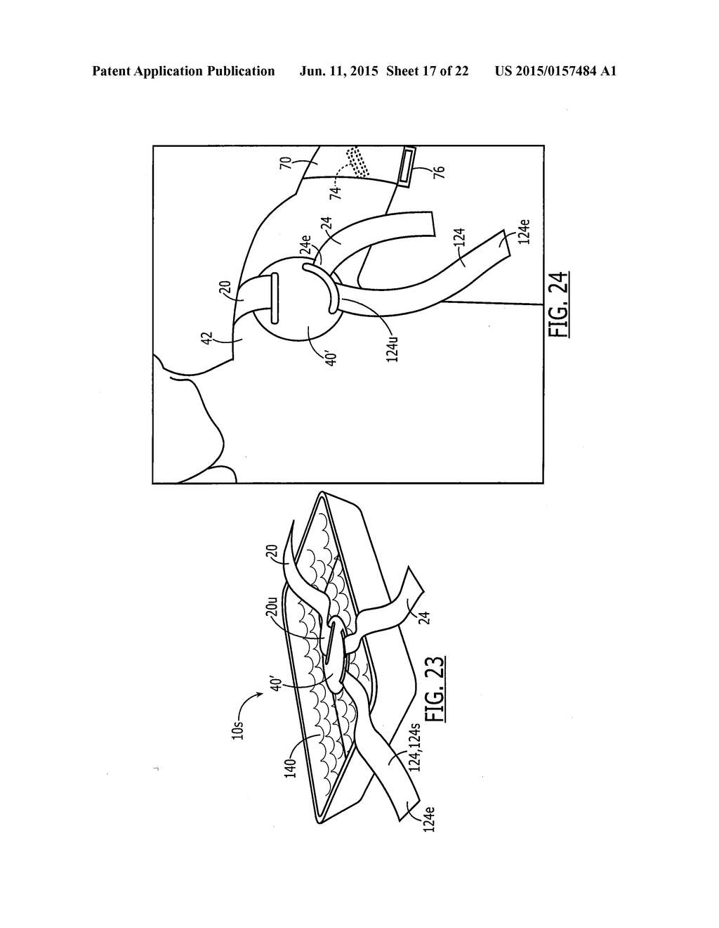 SEMI-RIGID SHOULDER BRACES AND RELATED METHODS - diagram, schematic, and image 18