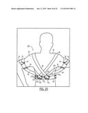 SEMI-RIGID SHOULDER BRACES AND RELATED METHODS diagram and image