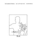 SEMI-RIGID SHOULDER BRACES AND RELATED METHODS diagram and image