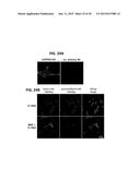 METHODS OF REGULATING CANNABINOID RECEPTOR ACTIVITY-RELATED DISORDERS AND     DISEASES diagram and image