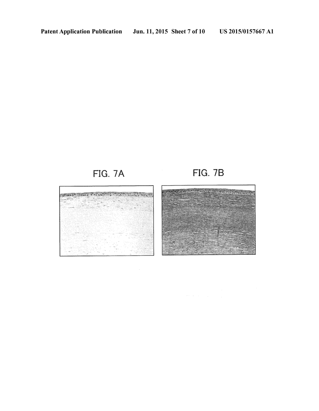 METHOD FOR PREPARING DECELLULARIZED TISSUE PRODUCT, AND GRAFT PROVIDED     WITH DECELLULARIZED TISSUE PRODUCT - diagram, schematic, and image 08