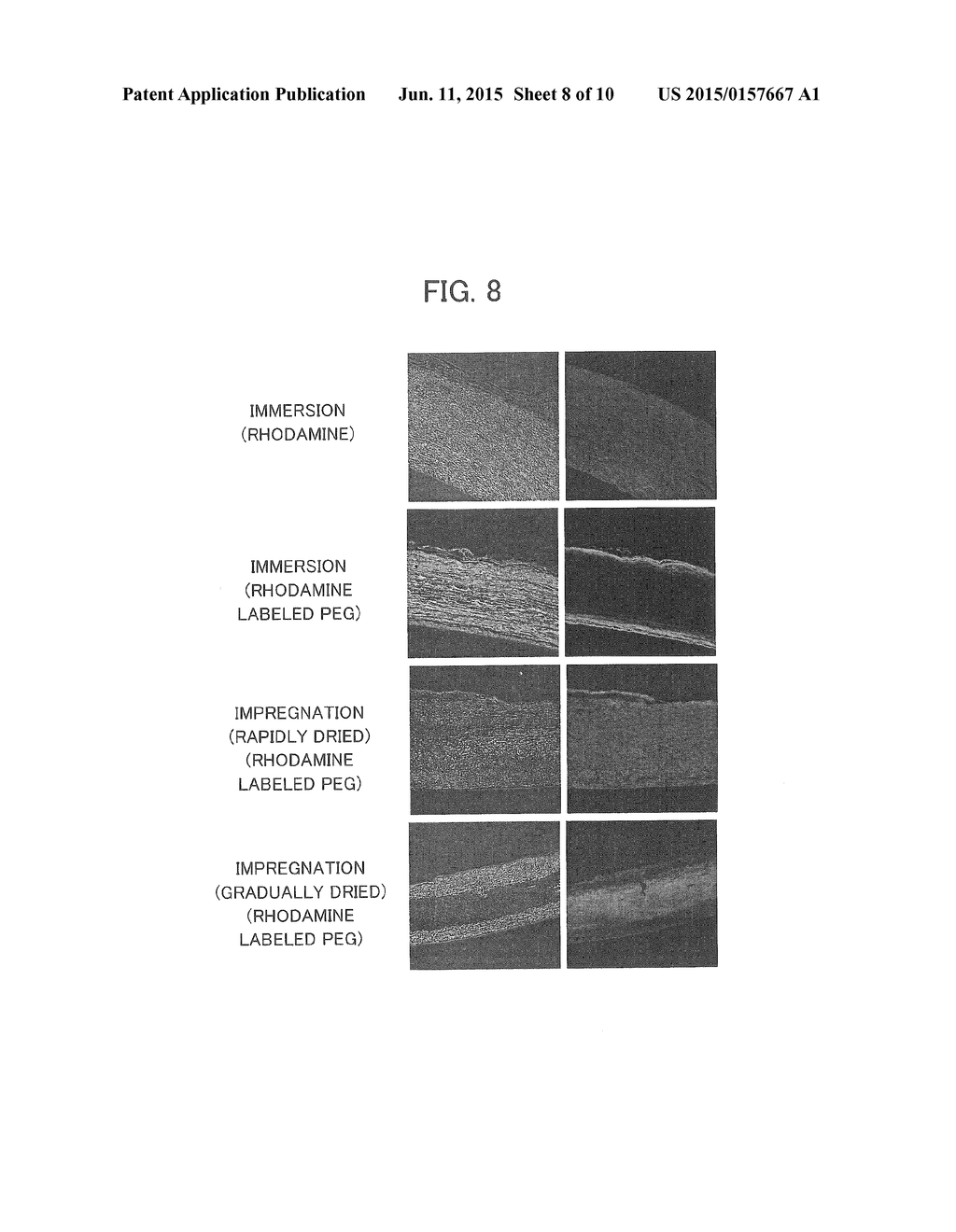 METHOD FOR PREPARING DECELLULARIZED TISSUE PRODUCT, AND GRAFT PROVIDED     WITH DECELLULARIZED TISSUE PRODUCT - diagram, schematic, and image 09