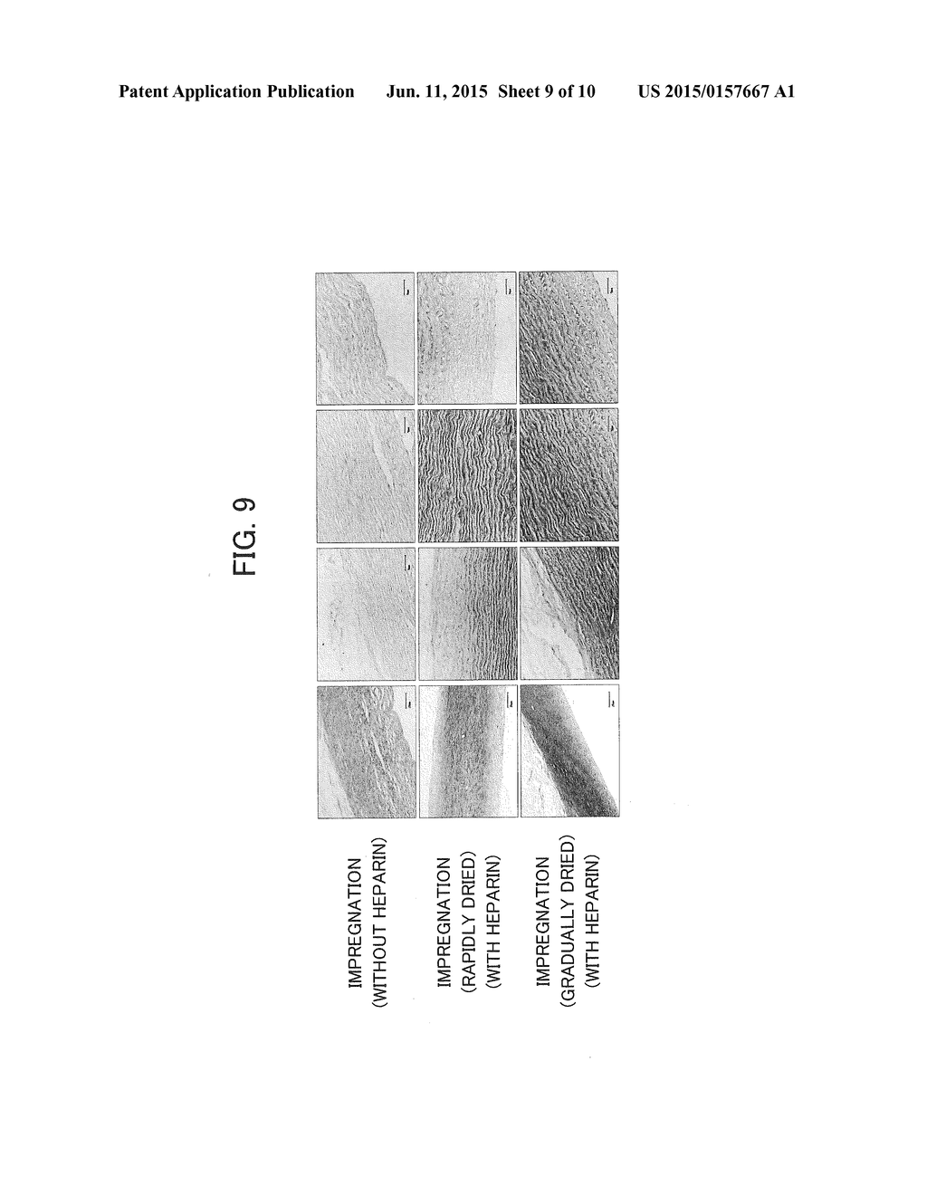 METHOD FOR PREPARING DECELLULARIZED TISSUE PRODUCT, AND GRAFT PROVIDED     WITH DECELLULARIZED TISSUE PRODUCT - diagram, schematic, and image 10