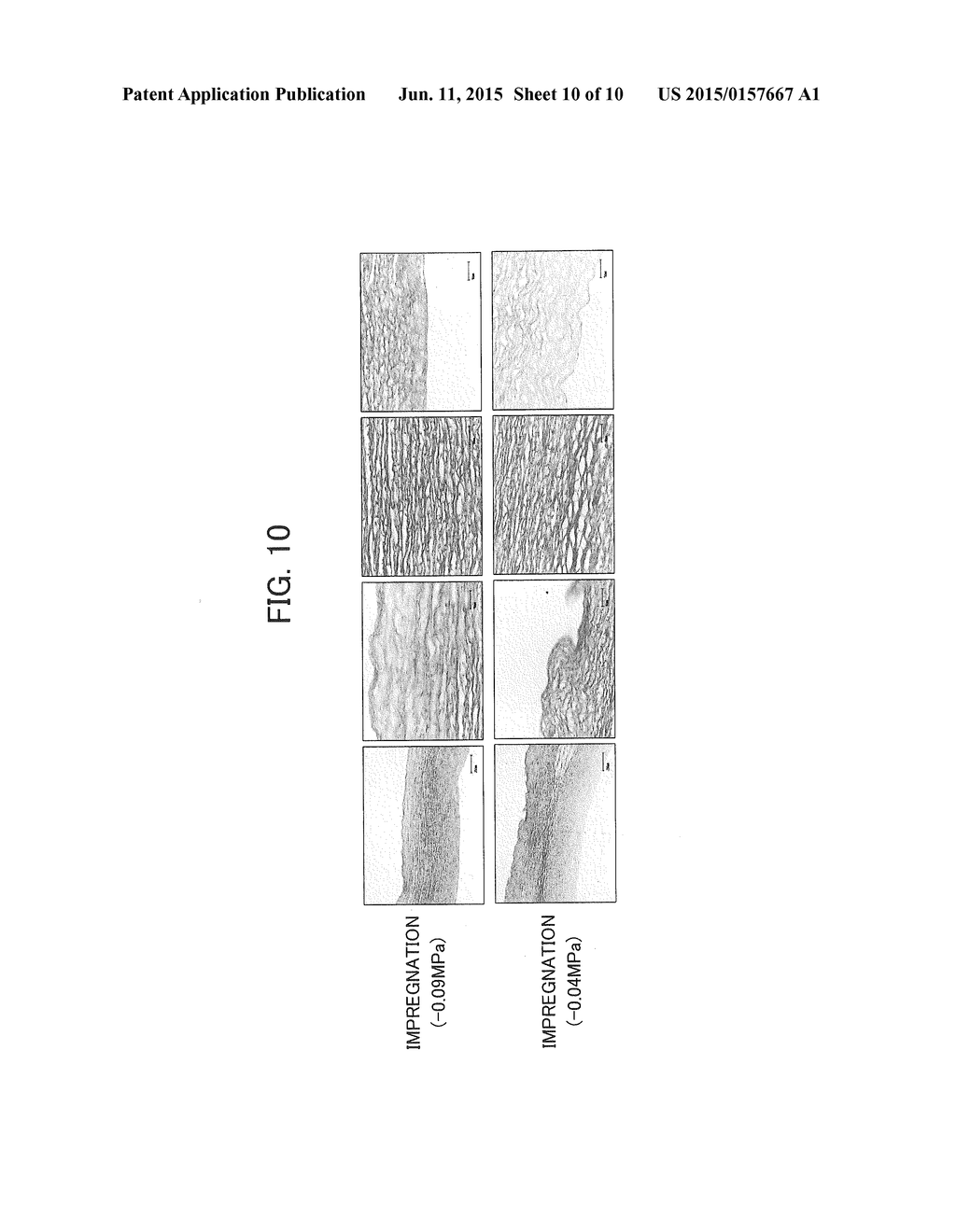 METHOD FOR PREPARING DECELLULARIZED TISSUE PRODUCT, AND GRAFT PROVIDED     WITH DECELLULARIZED TISSUE PRODUCT - diagram, schematic, and image 11