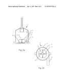 Method and Apparatus for Removal of Gas Bubbles from Blood diagram and image