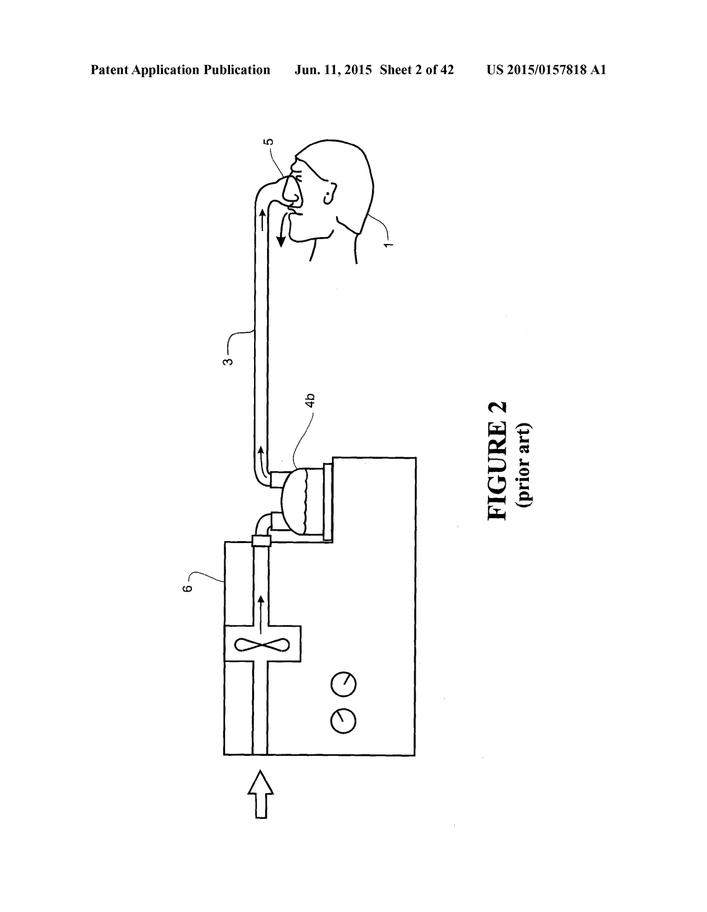 RESPIRATORY ASSISTANCE APPARATUS - diagram, schematic, and image 03