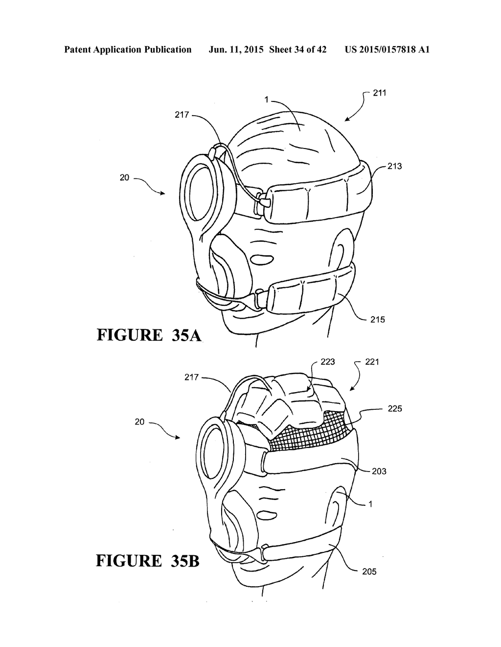 RESPIRATORY ASSISTANCE APPARATUS - diagram, schematic, and image 35