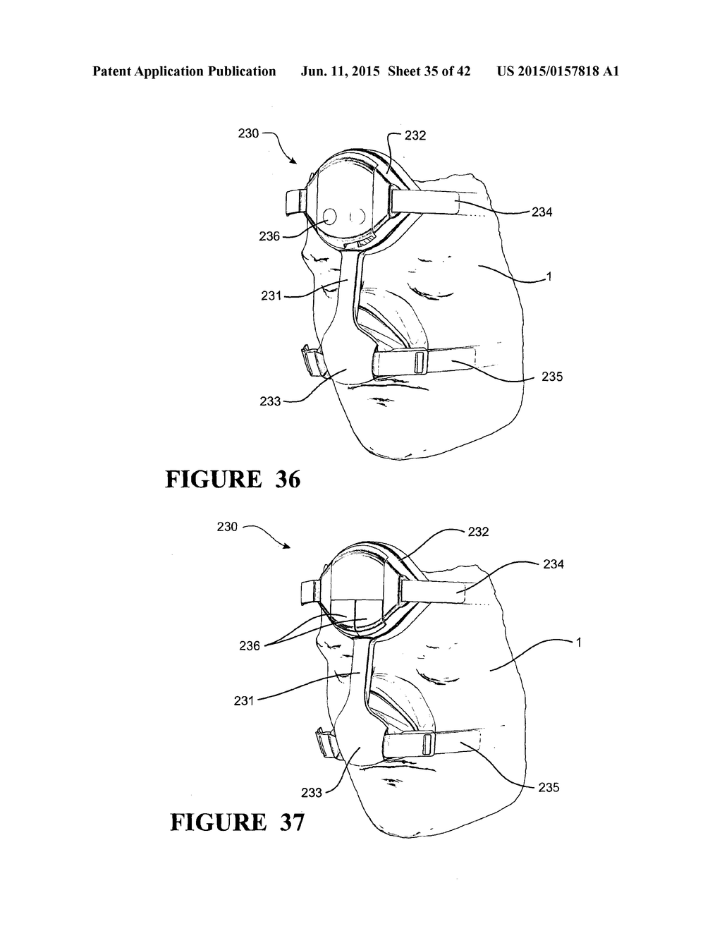 RESPIRATORY ASSISTANCE APPARATUS - diagram, schematic, and image 36