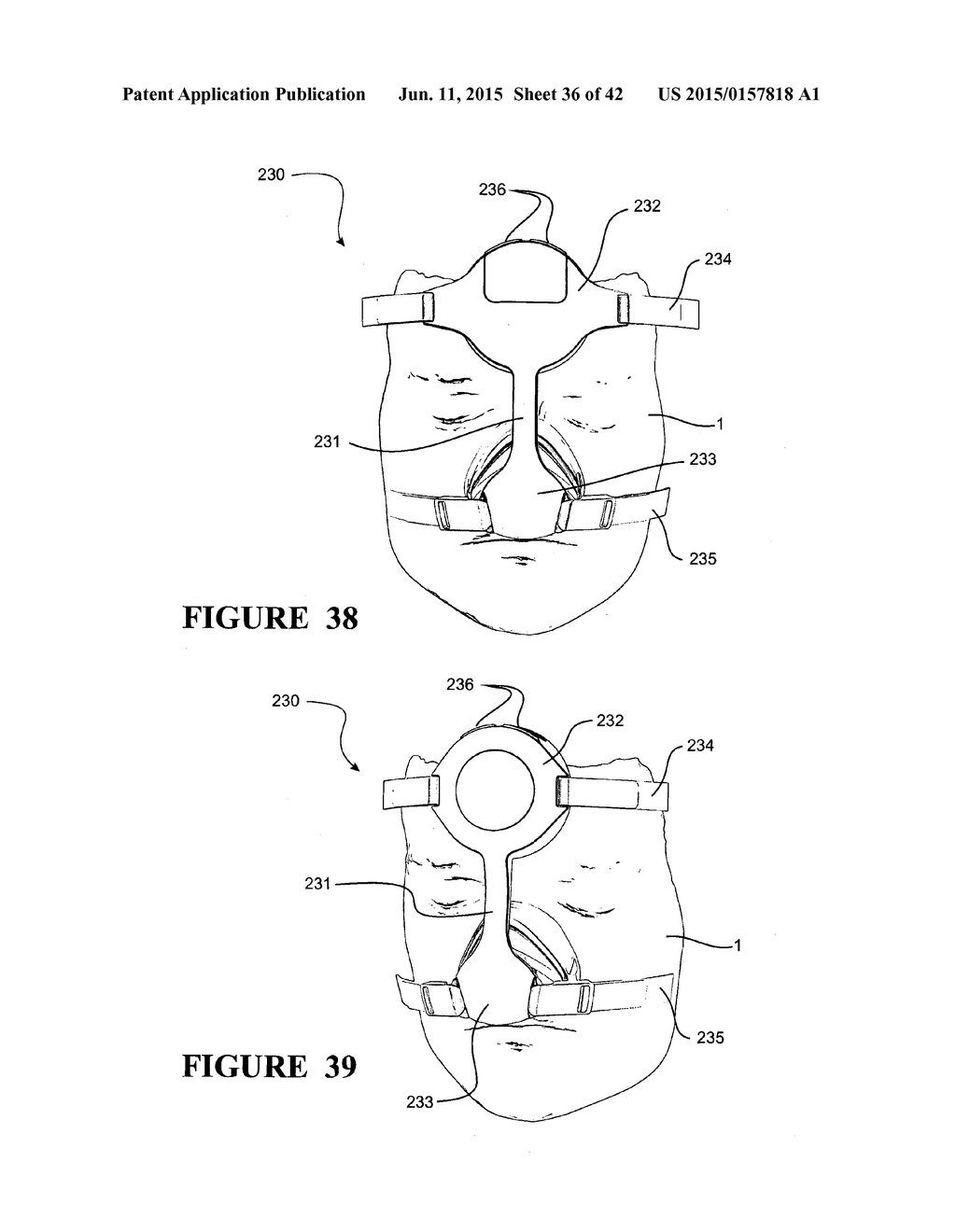 RESPIRATORY ASSISTANCE APPARATUS - diagram, schematic, and image 37