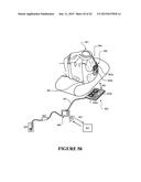 RESPIRATORY ASSISTANCE APPARATUS diagram and image