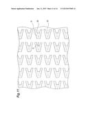 Microneedle Sheet diagram and image