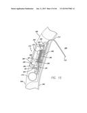 Cortical Implant System for Brain Stimulation and Recording diagram and image