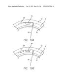 Cortical Implant System for Brain Stimulation and Recording diagram and image