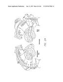 Cortical Implant System for Brain Stimulation and Recording diagram and image