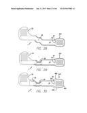 Cortical Implant System for Brain Stimulation and Recording diagram and image