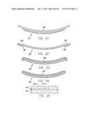 Cortical Implant System for Brain Stimulation and Recording diagram and image