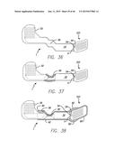 Cortical Implant System for Brain Stimulation and Recording diagram and image