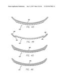 Cortical Implant System for Brain Stimulation and Recording diagram and image