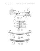 Cortical Implant System for Brain Stimulation and Recording diagram and image