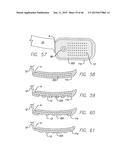 Cortical Implant System for Brain Stimulation and Recording diagram and image