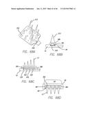 Cortical Implant System for Brain Stimulation and Recording diagram and image