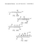 Cortical Implant System for Brain Stimulation and Recording diagram and image