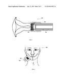 Device for Treating Cancer by Hyperthermia and the Method Thereof diagram and image