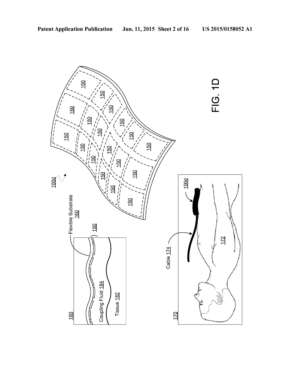 FLEXIBLE MICROMACHINED TRANSDUCER DEVICE AND METHOD FOR FABRICATING SAME - diagram, schematic, and image 03