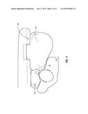 MULTI-CHAMBER AIRBAGS diagram and image