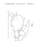 MULTI-CHAMBER AIRBAGS diagram and image