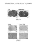 SALICYCLIC ACID DERIVATIVES, PHARMACEUTICALLY ACCEPTABLE SALT THEREOF,     COMPOSITION THEREOF AND METHOD OF USE THEREOF diagram and image